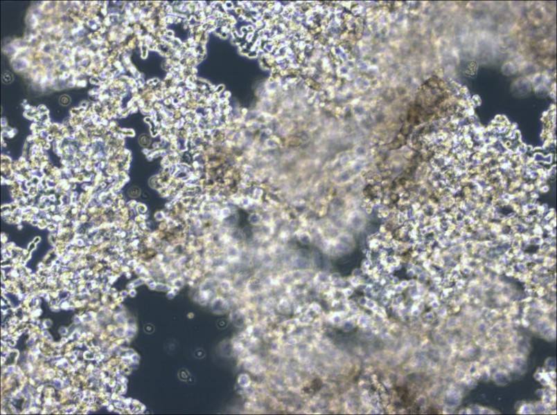 NCI-H526 Cell Complete Medium - 2