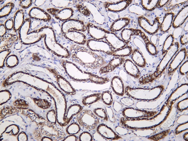 Recombinant FH Monoclonal Antibody - 1