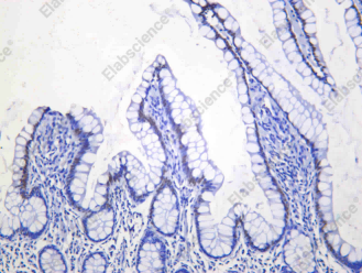 Recombinant HNF1A Monoclonal Antibody - 1