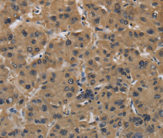FABP2 Polyclonal Antibody - 2