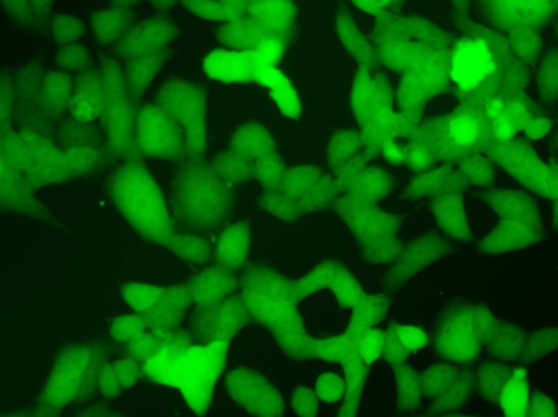 NCI-H446-LUC-EGFP Cell Complete Medium - 10