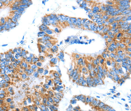 AIFM1 Polyclonal Antibody - 3