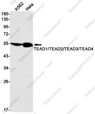 Recombinant TEAD1/TEAD2/TEAD3/TEAD4 Monoclonal Antibody - 1