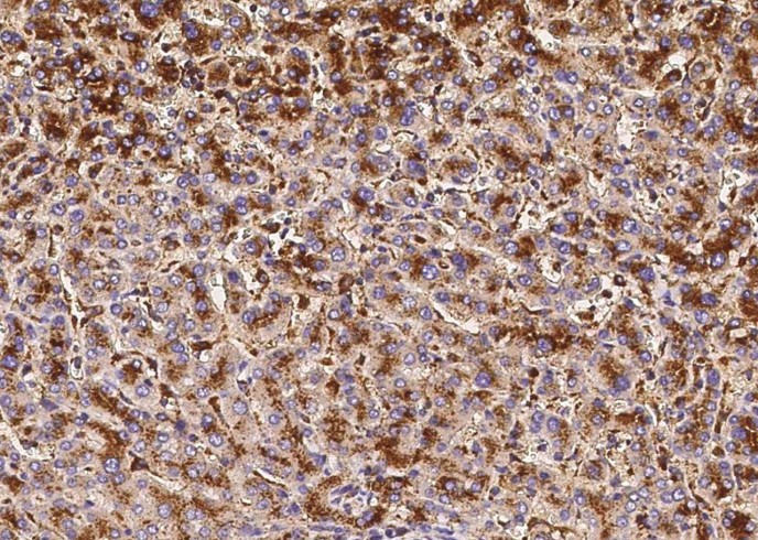 LAMP2/CD107b Monoclonal Antibody - small - 2