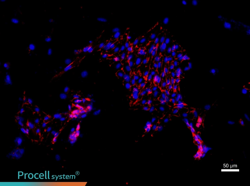 Mouse Pulmonary Great Artery Endothelial Cell Complete Medium - 1