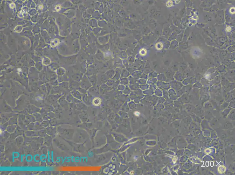 OVCAR-5 Cell Complete Medium - 5