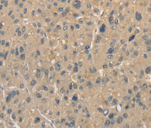ALDH8A1 Polyclonal Antibody - 2