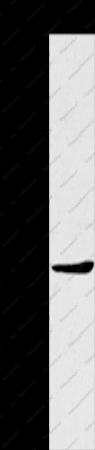 TNIP2 Polyclonal Antibody - 1