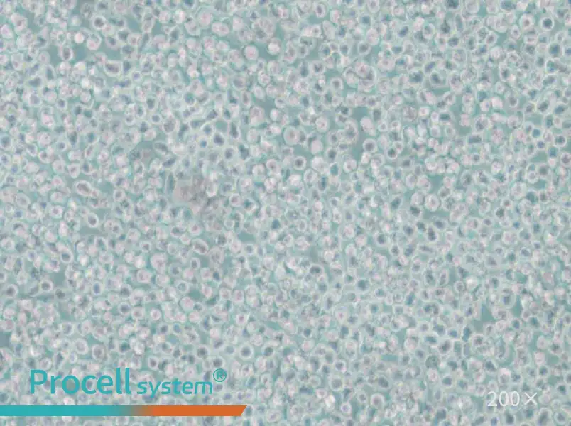 SKNO-1 Cell Complete Medium - 6