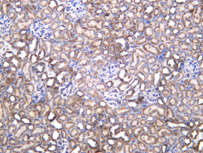 Recombinant NDUFB9 Monoclonal Antibody - 3
