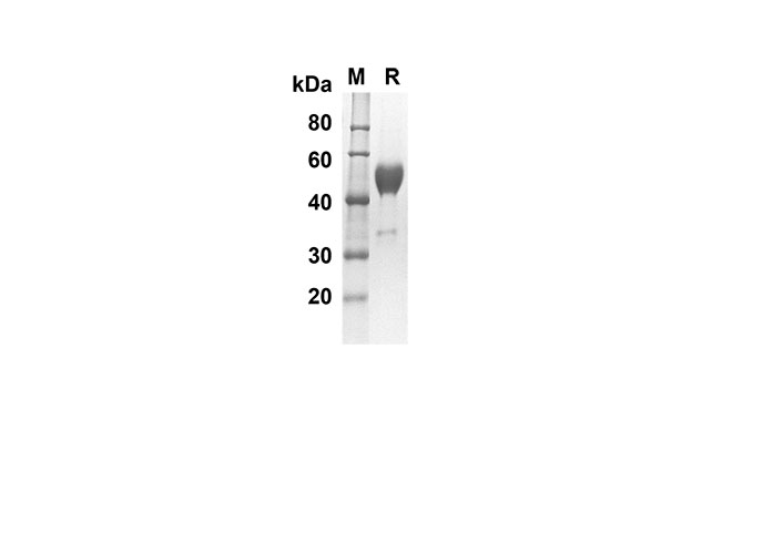 Recombinant Human IL17D Protein(Sumo Tag)-产品推荐-1