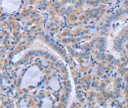 CD36 Polyclonal Antibody - 2