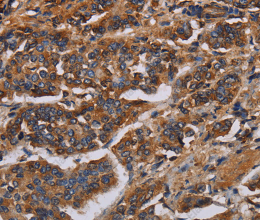 KCNQ1 Polyclonal Antibody - 2