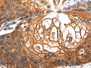 SERPINB5 Polyclonal Antibody - 1
