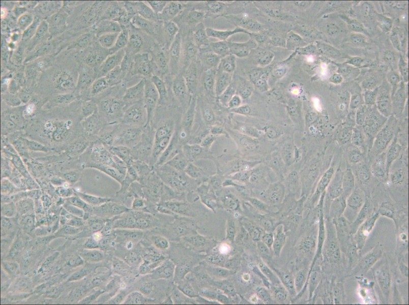 PUMC-HUVEC-T1 Cell Complete Medium - small - 5