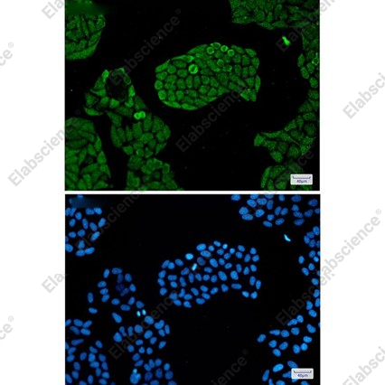 Recombinant PSMC5 Monoclonal Antibody - 3