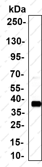 Recombinant MACROH2A1 Monoclonal Antibody - 5