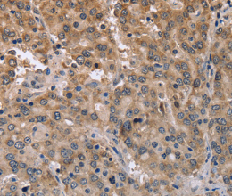 MAPRE3 Polyclonal Antibody - 3