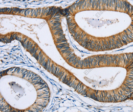SULT1B1 Polyclonal Antibody - 2