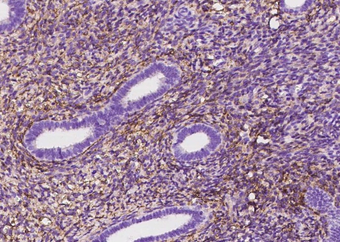CD10 Monoclonal Antibody - small - 4