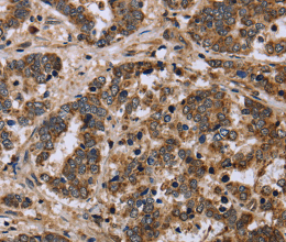 FH Polyclonal Antibody - 2