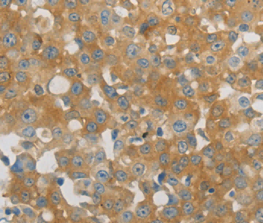PLPP1 Polyclonal Antibody - 2