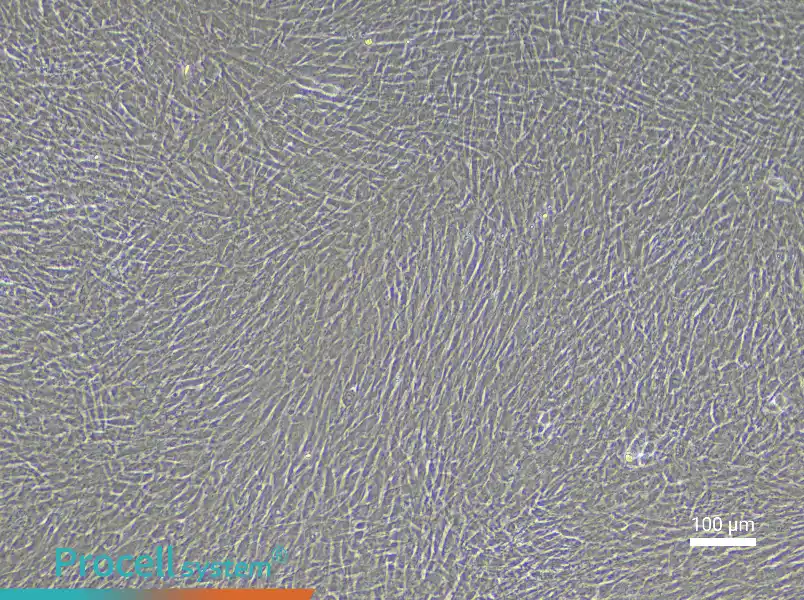 Rabbit Pulmonary Great Artery Smooth Muscle Cell Complete Medium - 1
