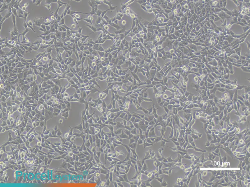 TC-1 [Mouse lung]TC-1 [Mouse lung] - 2