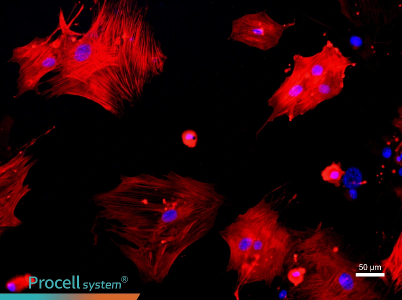 Mouse Aortic Smooth Muscle CellsMouse Aortic Smooth Muscle Cells - 2