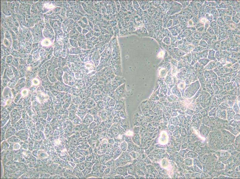 NCI-H2228 [H2228; H-2228] Cell Complete Medium - small - 5