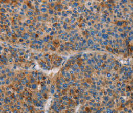 AMBP Polyclonal Antibody - 2