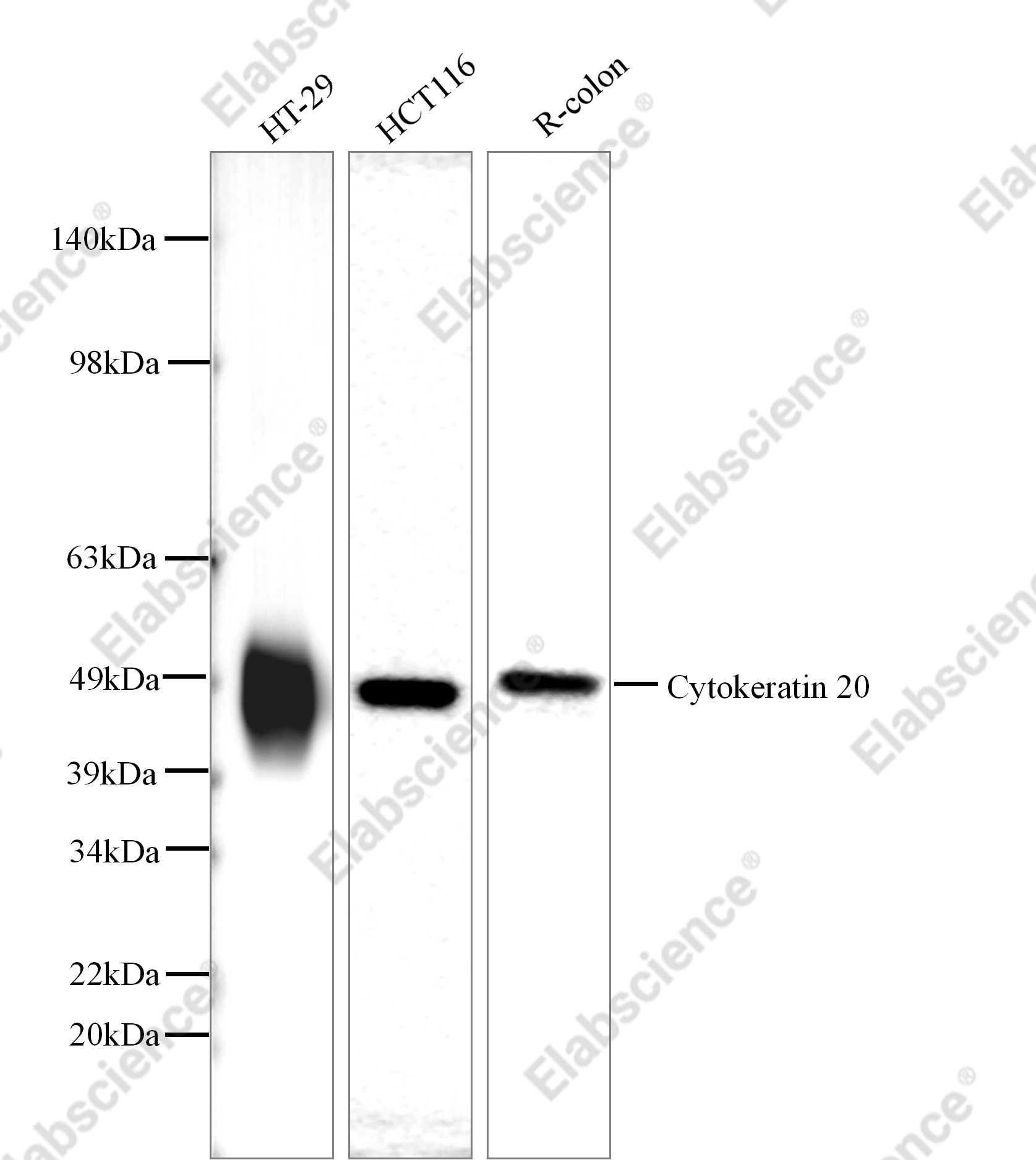 Recombinant Cytokeratin 20 Monoclonal Antibody - 1