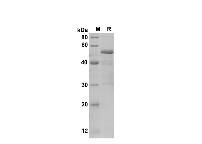 Recombinant Human CDH1 Protein(Sumo Tag)-产品推荐-1