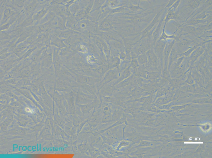 Rat Chondrocytes (Primary cell immortalization)Rat Chondrocytes (Primary cell immortalization) - 4