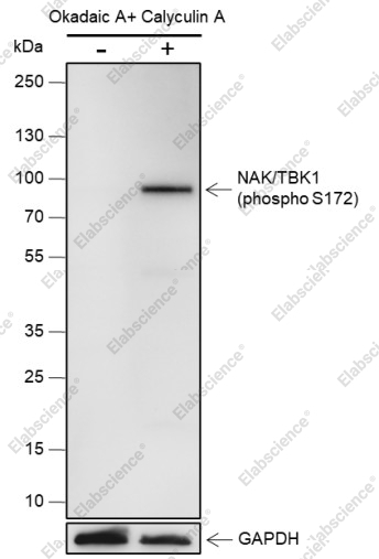 Recombinant Phospho-TBK1/NAK (Ser172) Monoclonal Antibody - 1