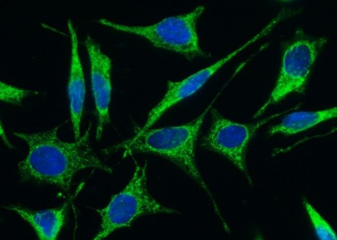 Recombinant FSTL1 Monoclonal Antibody - small - 2