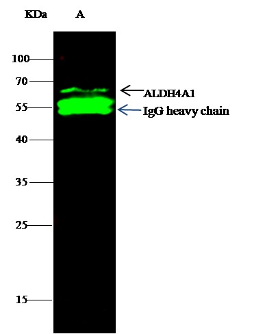 Recombinant ALDH4A1 Monoclonal Antibody - small - 1