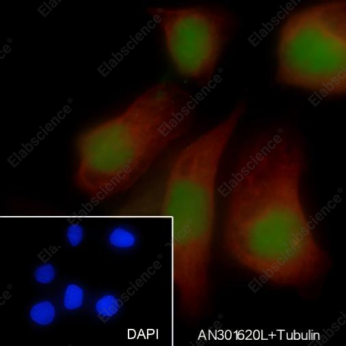 Recombinant PAX8 Monoclonal Antibody - 4