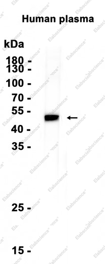 Recombinant IgG4 Monoclonal Antibody - 1