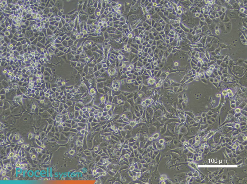 Human Bronchial Epithelial Cell Complete Medium - 3