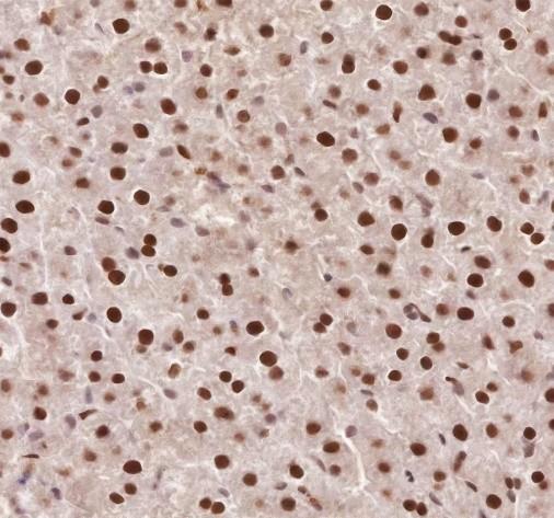 Recombinant APE1 Monoclonal Antibody - small - 4