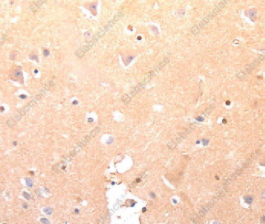 CAPNS1 Polyclonal Antibody - 3