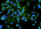 Recombinant N-Cadherin/CD325/CDH2 Monoclonal Antibody - small - 2