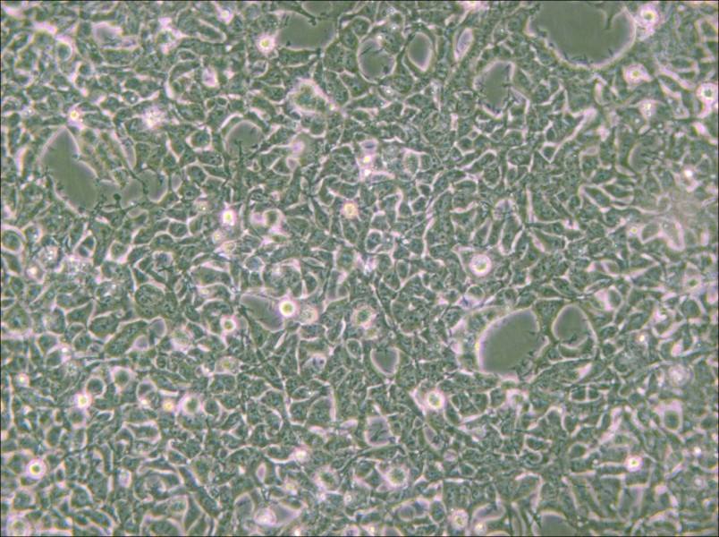 2V6.11 Cell Complete Medium - 5