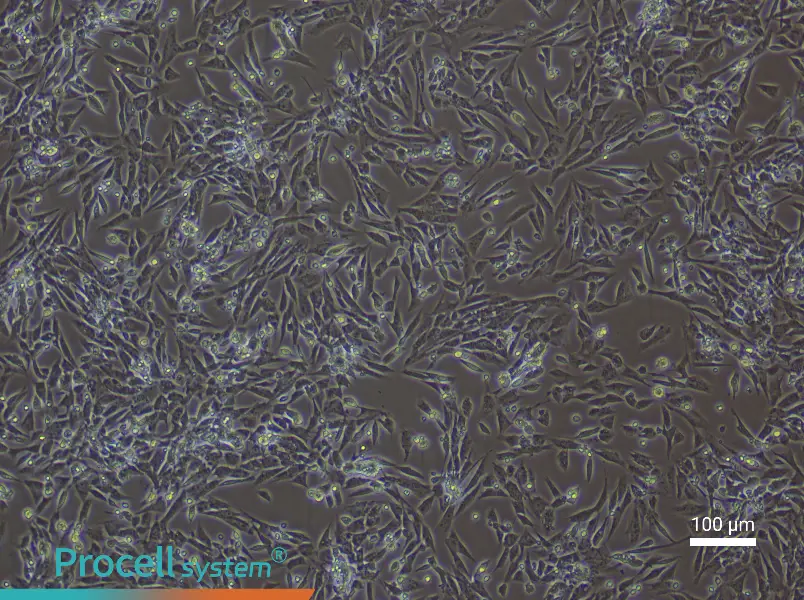 Rat Endometrial Stromal Cells - 1