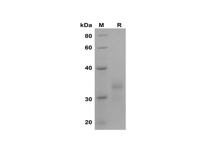 Recombinant Rat IL-1b Protein(Trx Tag)-产品推荐-1