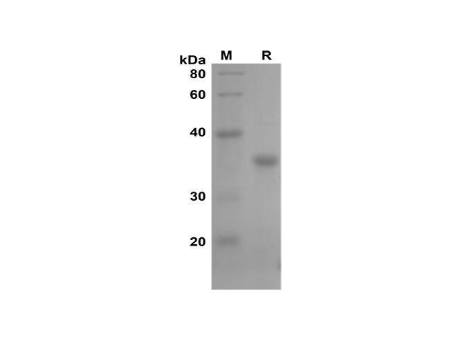 Recombinant Human IL-4 Protein-产品推荐-8