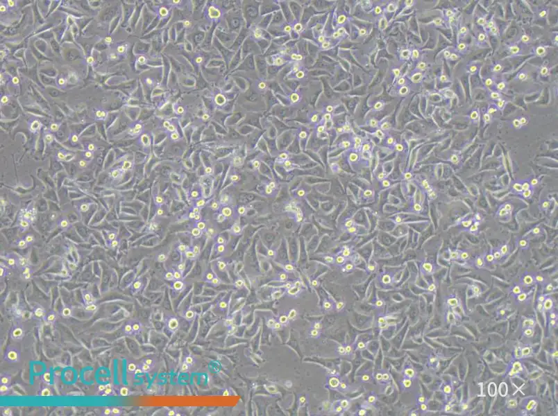 MKN1 Cell Complete Medium - 2