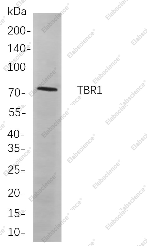 Recombinant TBR1 Monoclonal Antibody - 1