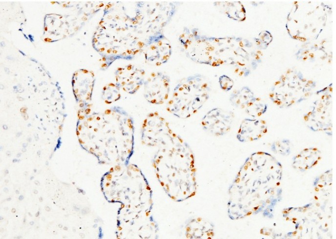 PARP-1/PARP Monoclonal Antibody - small - 1